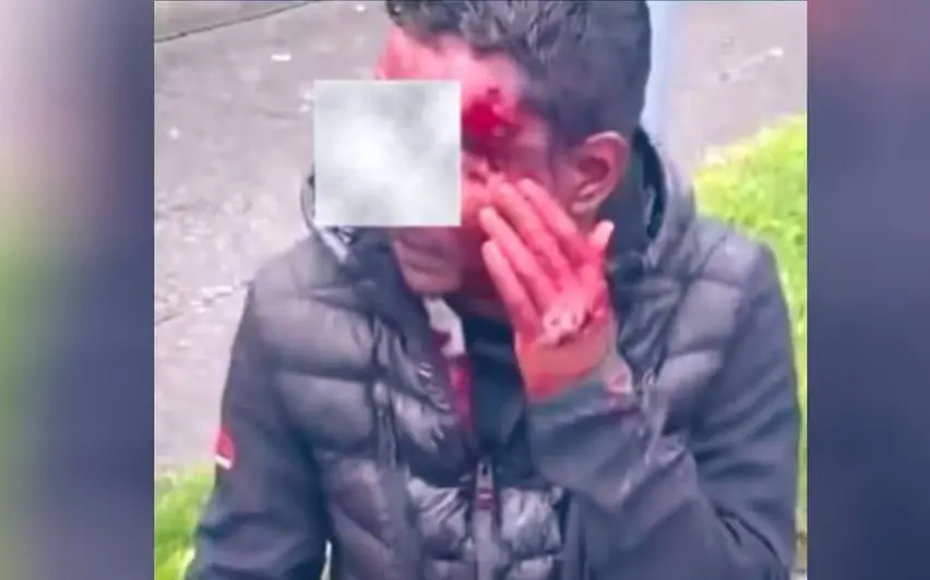 The photo of the survivor shared by the Indian Ambassador to Ireland