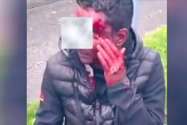 Unprovoked attack on Indian national in Dublin sparks outrage; Ambassador condemns media coverage
