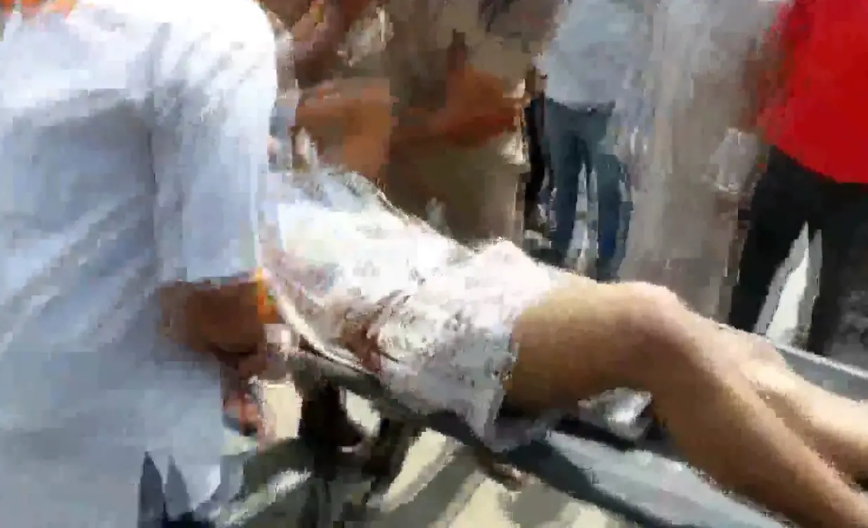 The injured being rushed to the hospital | ANI Video