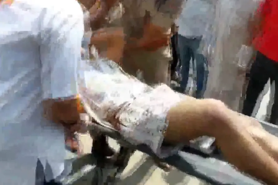 The injured being rushed to the hospital | ANI Video