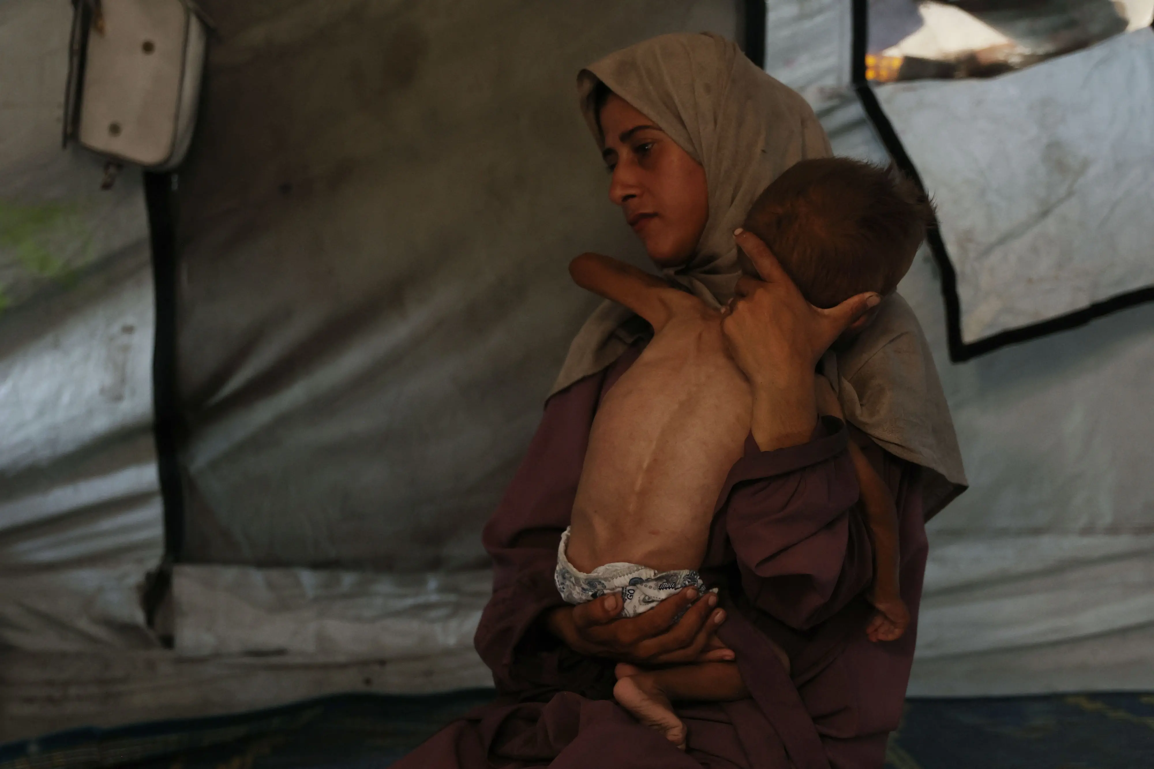 A Palestinian mother, carries her 18-month-old baby who is also displaying signs of malnutrition, inside their tent at the Al-Shati refugee camp, west of Gaza City. | Photo: Omar AL-QATTAA / AFP