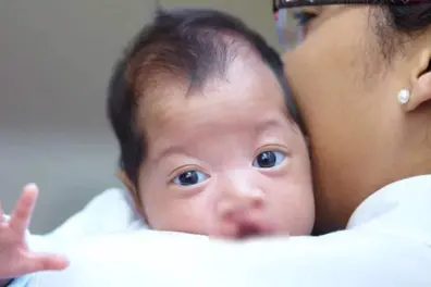 Major Kerala study investigates facial birth defects in children