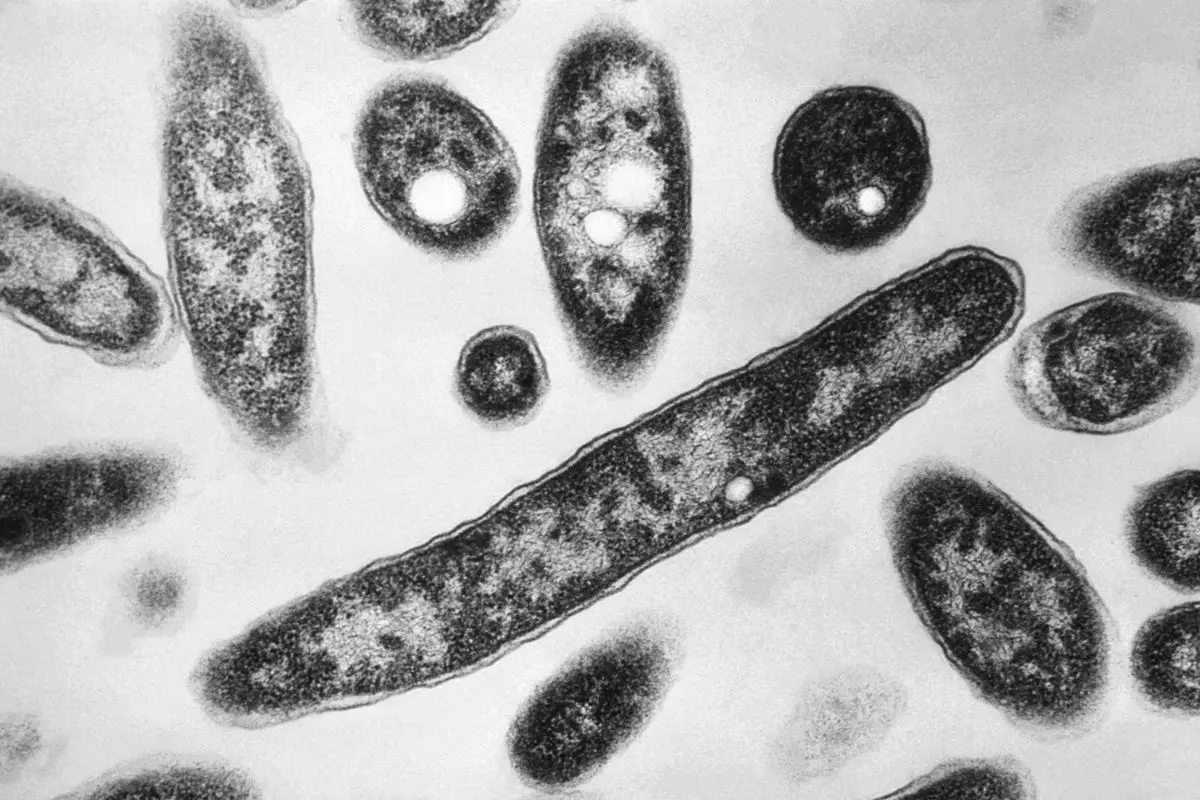 Legionella pneumophila bacteria which are responsible for causing the pneumonic disease Legionnaires' disease | Photo: AP