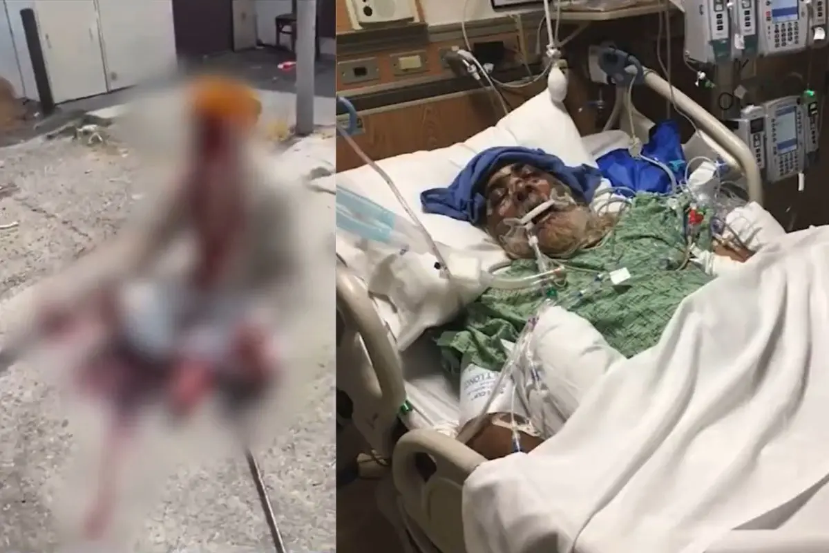 Harpal Singh remains in critical condition under medical supervision | Photo: Video screengrab/ X @TheKevinDalton