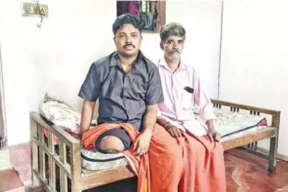 Thrissur youth loses leg after bike hits pothole; Police book rider, his own sibling