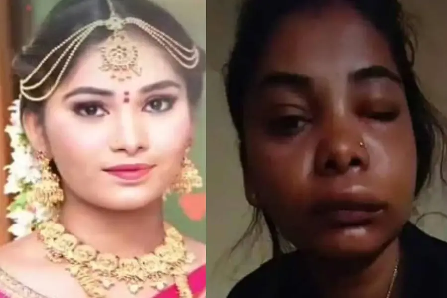 ശസ്ത്രക്രിയയില് പിഴവ്; തിരിച്ചറിയാവാനാത്ത അവസ്ഥയില് നടി സ്വാതി സതീഷ്