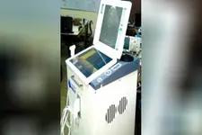 പെണ്‍ഭ്രൂണഹത്യ നടത്തുന്നത് കണ്ടെത്താം; മെഡിക്കല്‍ അള്‍ട്രാസൗണ്ട് സ്‌കാനര്‍ നിര്‍മിച്ച് നീലിറ്റ്