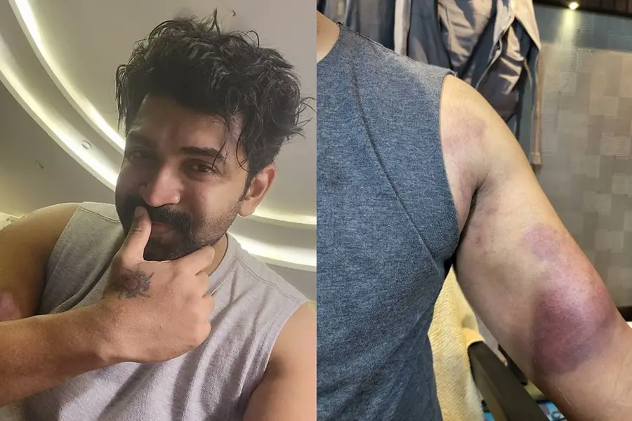 സംഘട്ടനരംഗങ്ങളുടെ ചിത്രീകരണത്തില് പരിക്കുകള് സാധാരണം, എന്നാലും ആക്ഷൻ ചെയ്യാനിഷ്ടം -അരുണ് വിജയ്