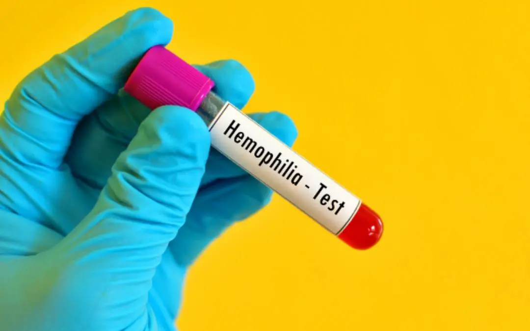 Representative Image| Photo: Canva.com