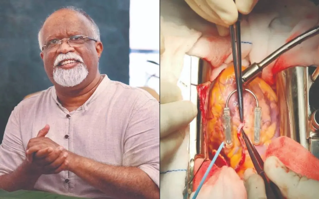 ഡോ.മുരളി പി. വെട്ടത്ത്, ഇന്ത്യൻനിർമിത സ്റ്റെബിലൈസർ ഉപയോഗിച്ച് ഹൃദയശസ്ത്രക്രിയ ചെയ്യുന്നു