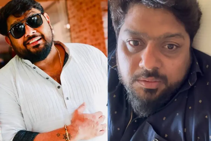 ചിരിക്കാനോ കണ്ണടയ്ക്കാനോ കഴിയുന്നില്ല; എന്താണ് മിഥുൻ രമേശിനെ ബാധിച്ച ബെൽസ് പാൾസി?
