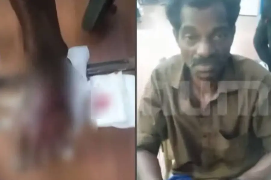 തിരുവനന്തപുരം വിതുരയില് കരടിയുടെ ആക്രമണം; ഒരാള്ക്ക് പരിക്ക്