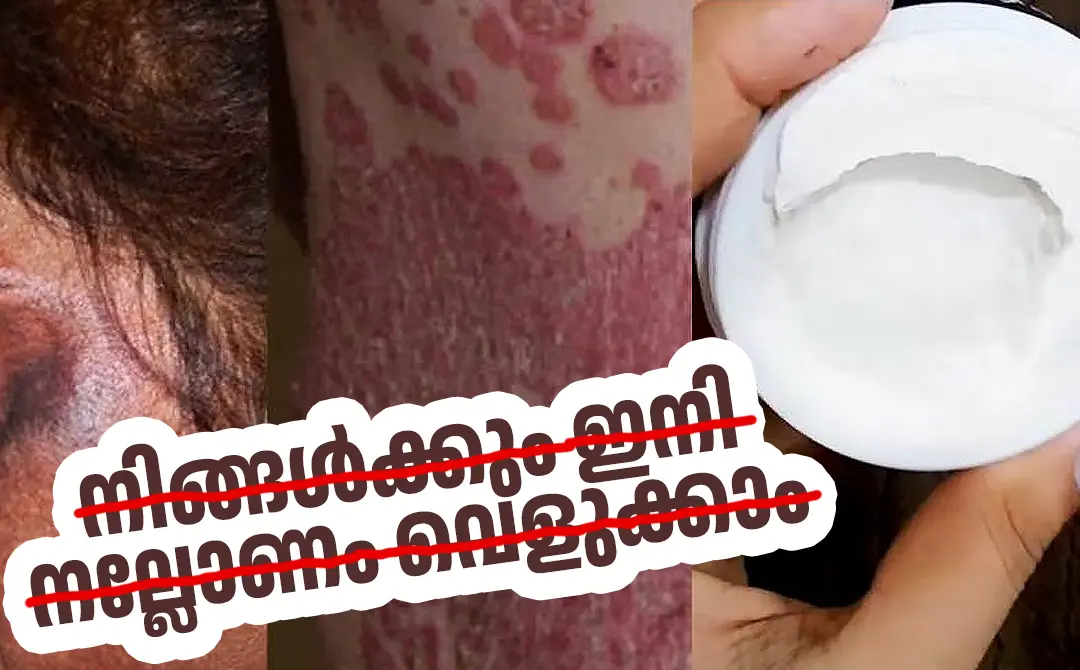 പ്രതീകാത്മക ചിത്രം