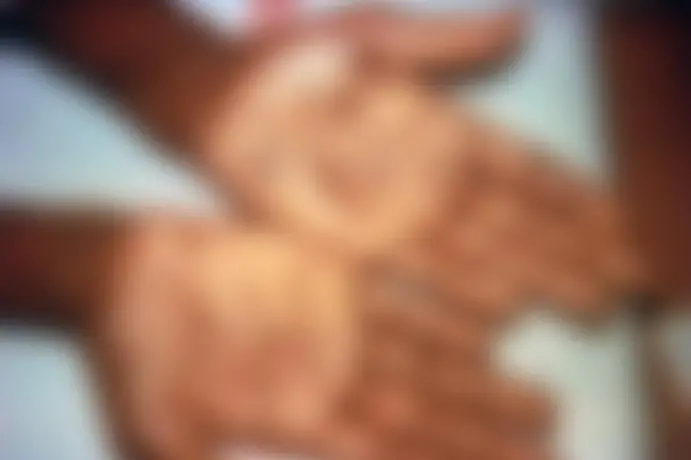 2019 മുതല്‍ ഹൂസ്റ്റണിലെ സ്ത്രീകള്‍ക്കിടയില്‍ സിഫിലിസ് 128% വര്‍ദ്ധിച്ചു