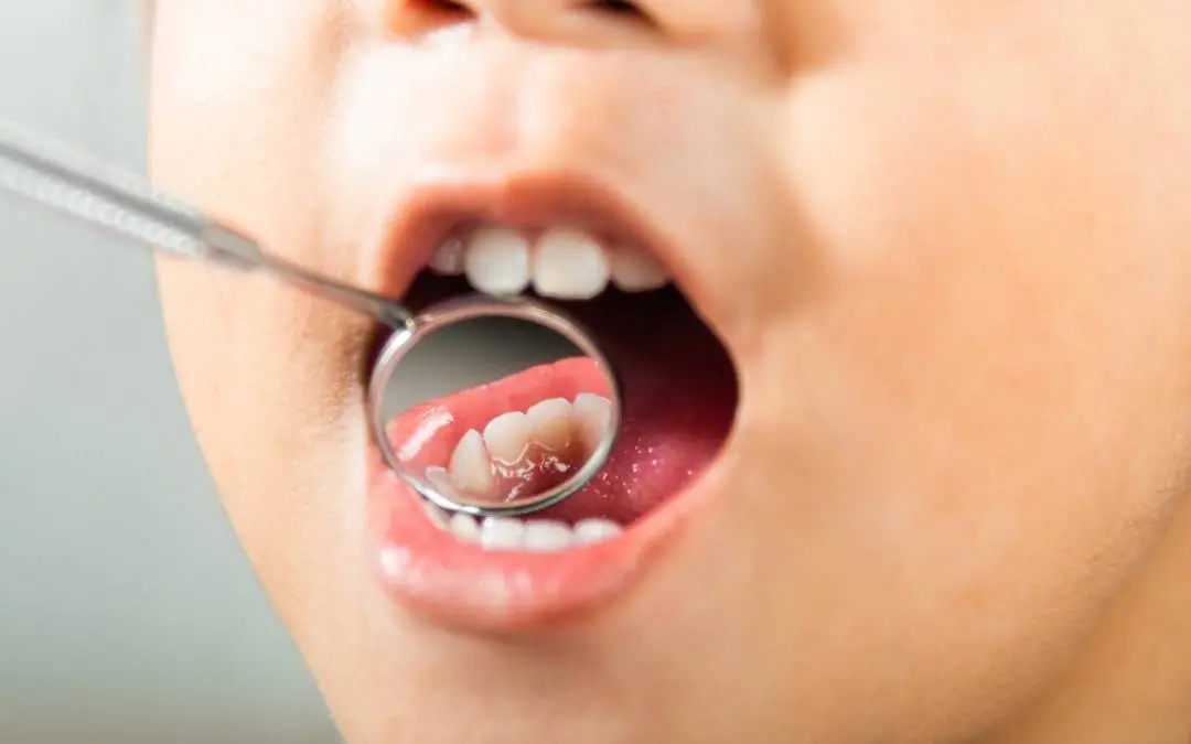 Representative Image| Photo: Canva.com