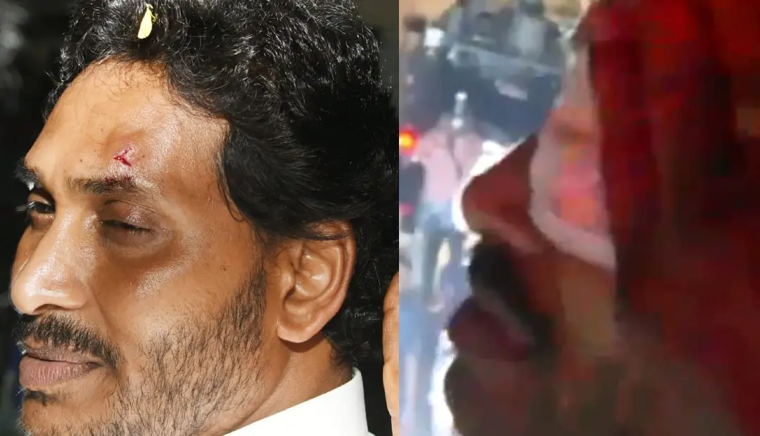കല്ലേറിൽ പരിക്കേറ്റ ജഗന്‍ മോഹന്‍ റെഡ്ഡി | Photo: @PoliticalViewsO