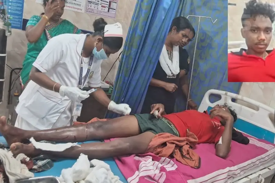 വാല്‍പാറയില്‍ മുതലയുടെ ആക്രമണത്തില്‍ വിദ്യാര്‍ഥിക്ക് ഗുരുതര പരിക്ക്