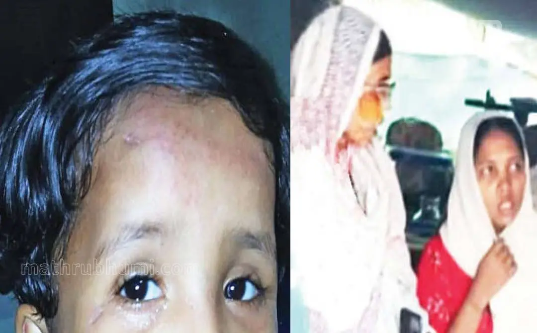 കുഞ്ഞിന്റെ മുഖത്തെ പരിക്കുകള്. രണ്ടാഴ്ച മുന്പ് റംലത്ത് ഫോണില് പകര്ത്തിയ ചിത്രം(ഇടത്ത്) റംലത്തും ശഹബാനത്തും സങ്കടം വിവരിക്കുന്നു(വലത്ത്) | ഫോട്ടോ: മാതൃഭൂമി