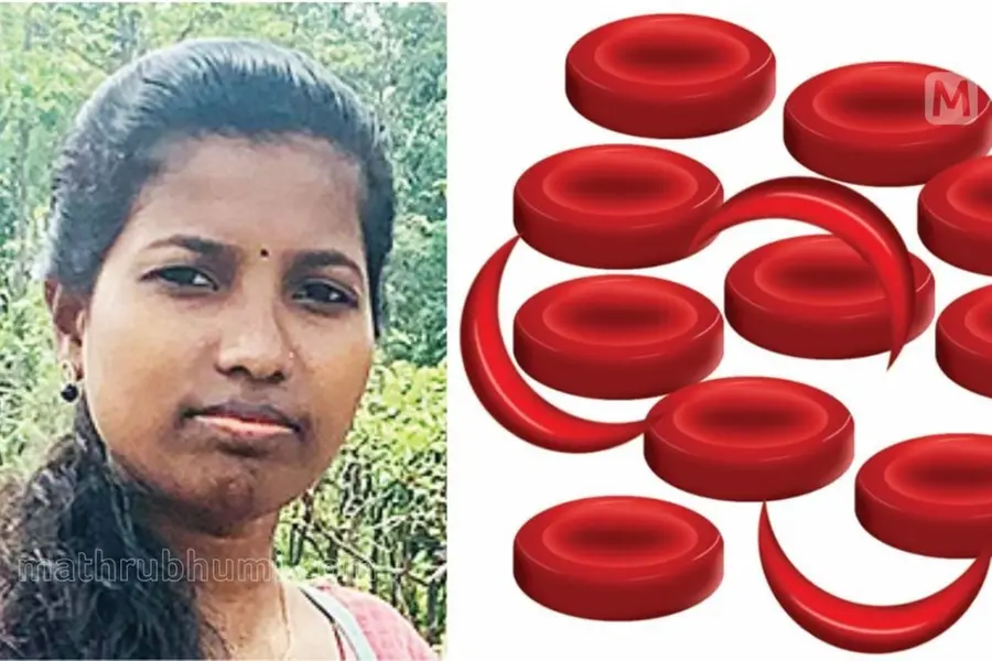 അരിവാള്‍ രോഗികളെ കണ്ടെത്താന്‍ പദ്ധതികളില്ല; അട്ടപ്പാടിയില്‍ രോഗം ബാധിച്ച് രണ്ട് യുവതികള്‍ മരിച്ചു