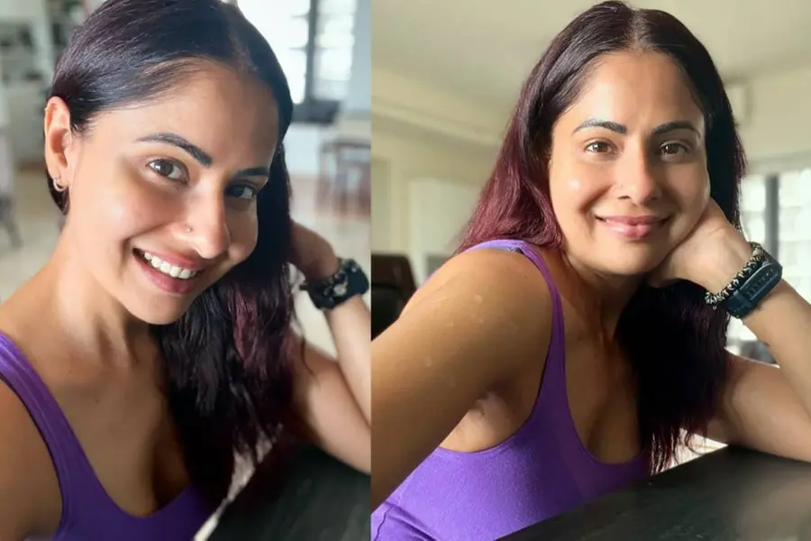 ശരീരത്തിൽ നൂറോളം പാടുകളുണ്ട്, ലൂപസ് രോഗം വീണ്ടും തിരികെവന്നതിനേക്കുറിച്ച് ഛവി മിത്തൽ