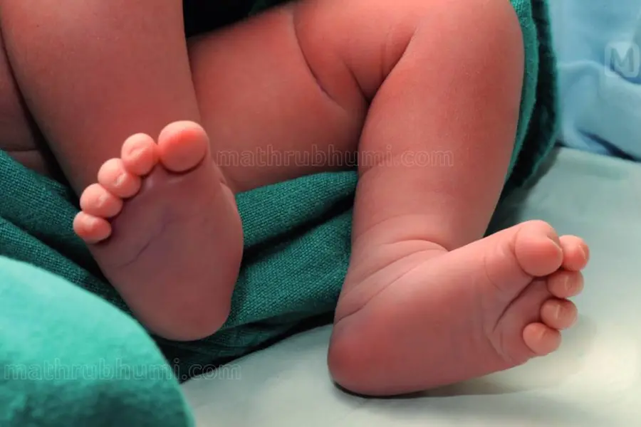 ഡോക്ടർമാരെ സർക്കാർ രക്ഷിക്കുന്നു, ഗുരുതര വൈകല്യങ്ങളോടെ ജനിച്ച കുട്ടിയുടെ കുടുംബം സമരത്തിലേക്ക്