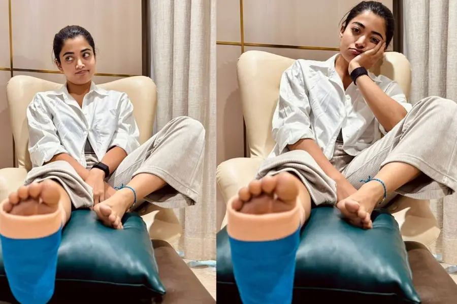വര്ക്കൗട്ടിനിടെ കാലിന് പരിക്ക്, ചിത്രം പങ്കുവെച്ച് രശ്മിക
