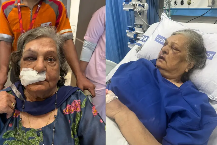 എയർഇന്ത്യയുടെ അനാസ്ഥ, വീൽചെയർ വൈകി; വിമാനത്താവളത്തിൽ വീണ് പരിക്കേറ്റ വയോധിക ഐസിയുവിൽ