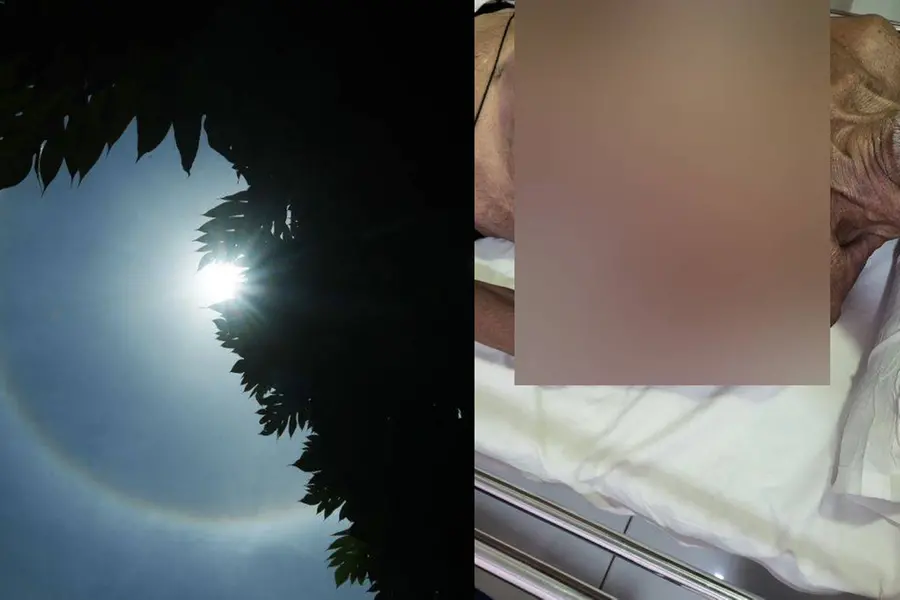 കാസര്കോട് സൂര്യാഘാതമേറ്റ് 92-കാരന് മരിച്ചു; പൊള്ളലേറ്റത് വീട്ടുമുറ്റത്തുവെച്ച്