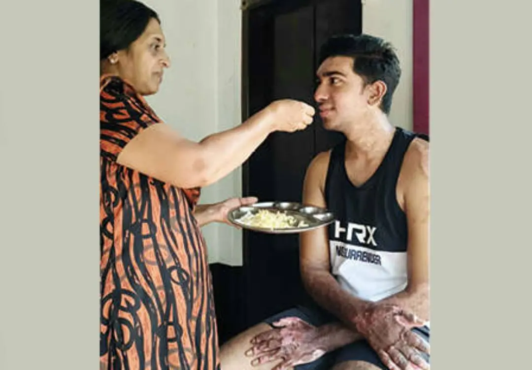 നീലേശ്വരം വെടിക്കെട്ടപകടത്തിൽ പരിക്കേറ്റ അലൻ നിനോയ്ക്ക് അമ്മ വിൽസി നിനോയ് ചോറ് വാരിക്കൊടുക്കുന്നു