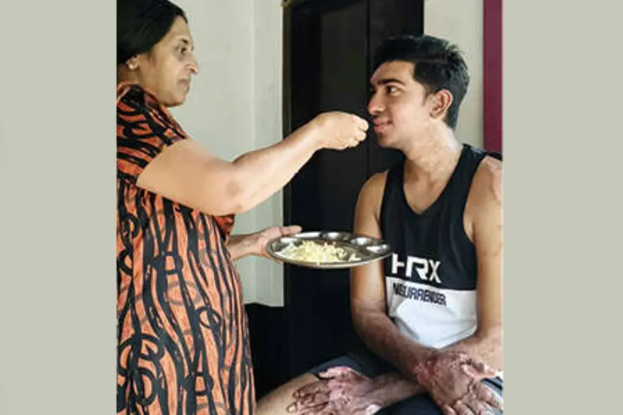 കൈകൾ മാംസം വളർന്ന് വികൃതമായി, ചോറ് കഴിക്കാൻ പോലുമാകില്ല; വെടിക്കെട്ടപകടം കവർന്നത് അലന്റെ സ്വപ്നങ്ങൾ