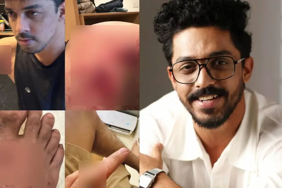 ആക്ഷന്‍ രംഗത്തിന്റെ ചിത്രീകരണത്തിനിടെ അപകടം; നടന്‍ സാഗര്‍ സൂര്യയ്ക്ക് പരിക്ക്‌