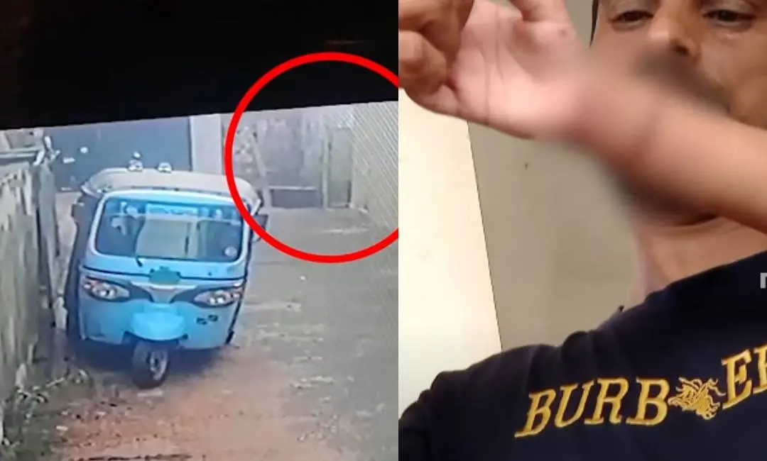 കുട്ടിയെ നായകടിക്കുന്ന സിസിടിവി ദൃശ്യങ്ങൾ, കുട്ടിയുടെ കയ്യിനേറ്റ മുറിവ്
