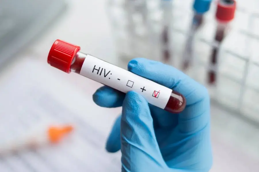 യുവാക്കളിൽ HIV ബാധ കൂടുന്നു, രോഗബാധിതനാണെന്നറിഞ്ഞാൽ ആദ്യം ചെയ്യേണ്ടതെന്ത്? എന്താണ് വിൻഡോ പീരിയഡ്?
