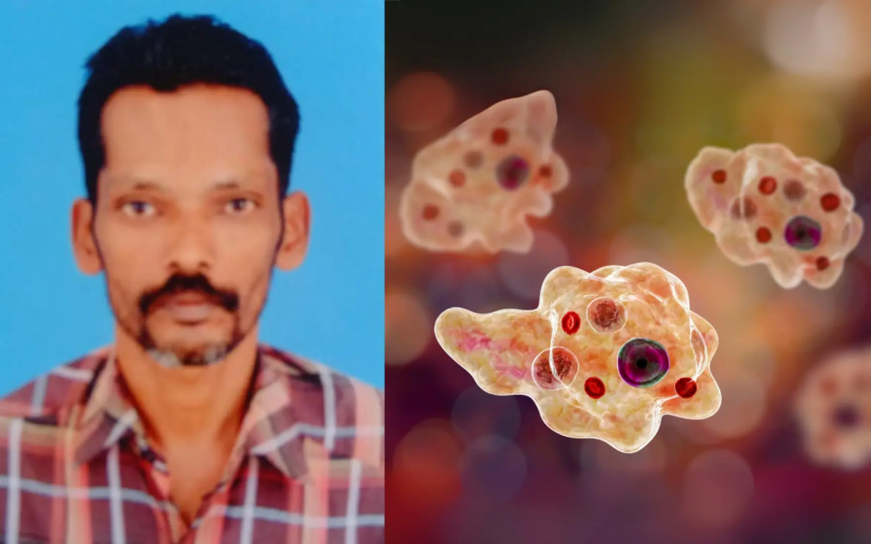 മരിച്ച ഷാജി, അമീബിക് മസ്തിഷ്കജ്വരത്തിന് കാരണമാകുന്ന അമീബ