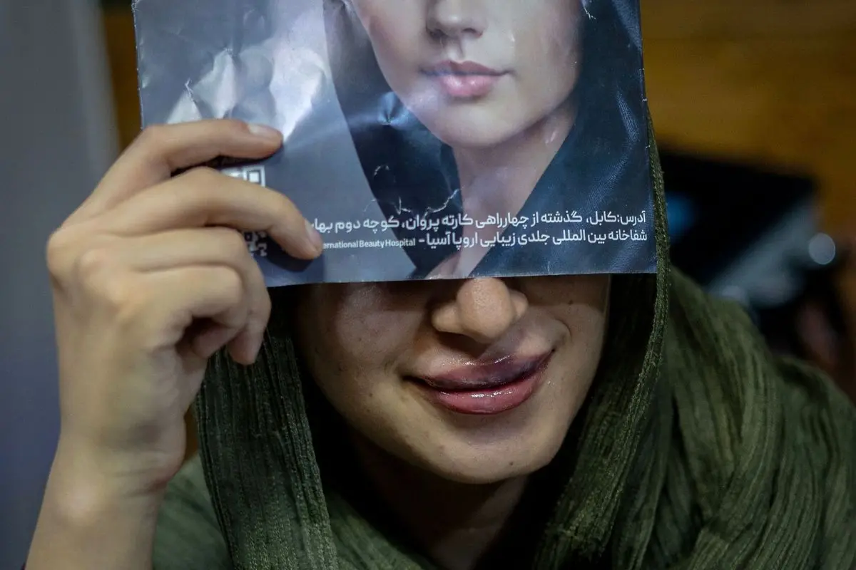 An Afghan woman poses for a photograph after a lip filler procedure at a beauty clinic in Kabul | Photo: AFP