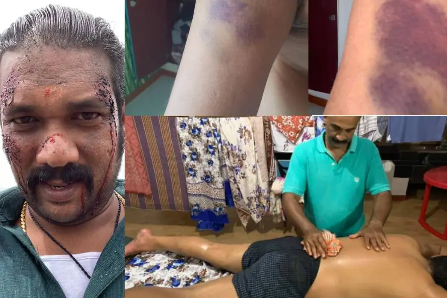 'അയ്യപ്പന് നായരുടെ ചവിട്ട് നെഞ്ചത്ത് വാങ്ങിയ കുട്ടമണിയുടെ അവസ്ഥ'