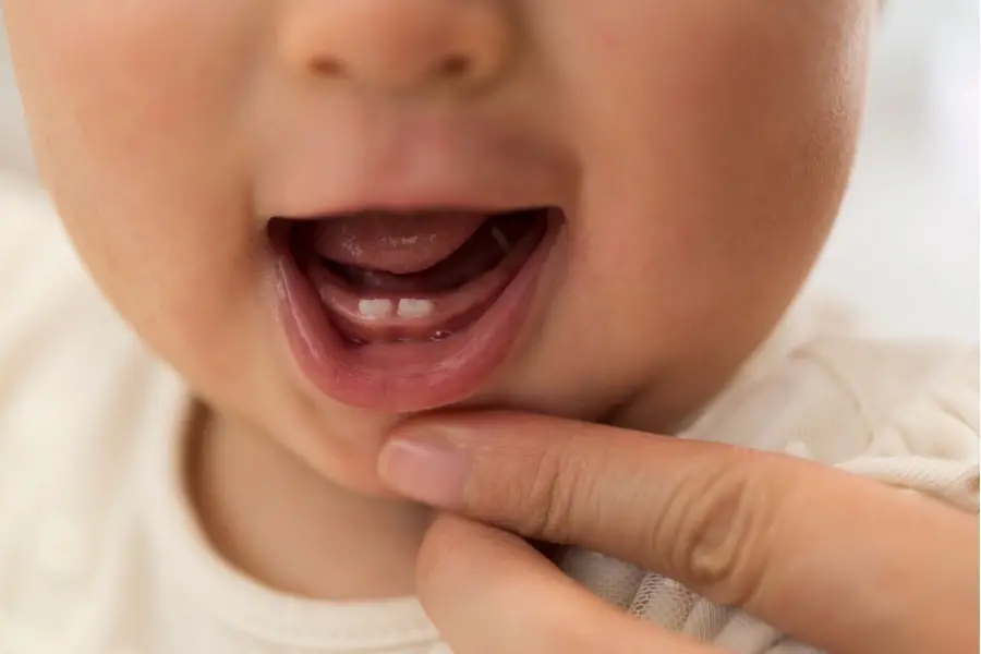 teething babies