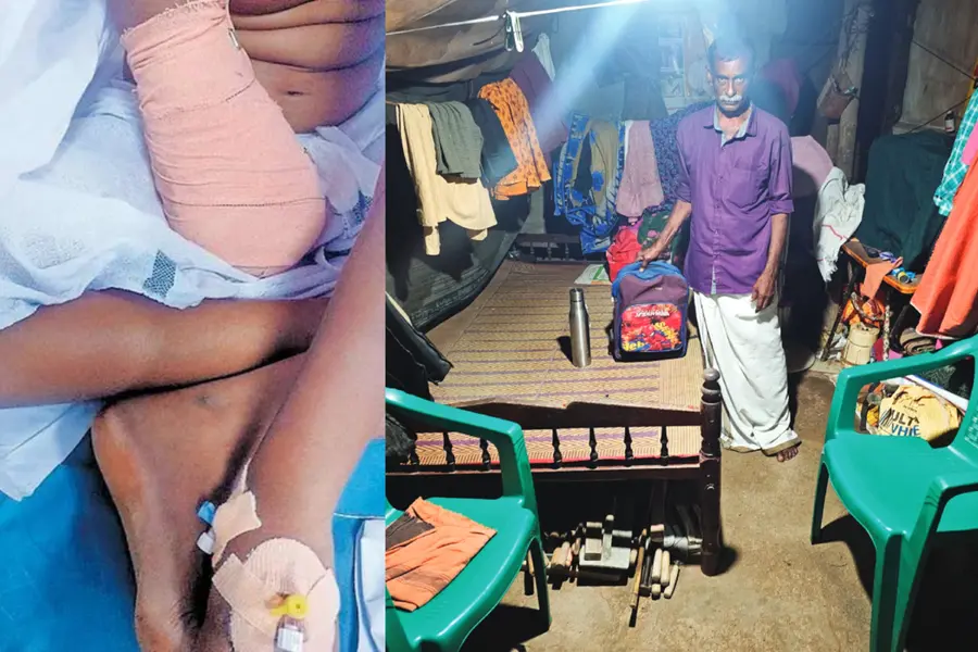 'അവളിനി എങ്ങനെ തലമുടി കെട്ടും, എങ്ങനെ പേന പിടിച്ചെഴുതും'; വലതുകൈ മുറിച്ചുമാറ്റപ്പെട്ട കുഞ്ഞിന്റെ മുത്തച്ഛന്‍ ചോദിക്കുന്നു