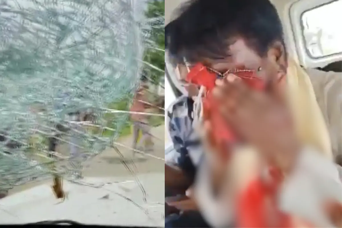 BJP leader injured in the attack | Photo: X/Amit Malviya