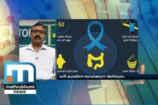 Colon Cancer: Everything You Need To Know- Doctor@2PM