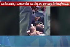 പുതുചരിത്രം! ജനിതകമാറ്റം വരുത്തിയ പന്നിവൃക്ക മനുഷ്യനിൽ മാറ്റിവെച്ചു