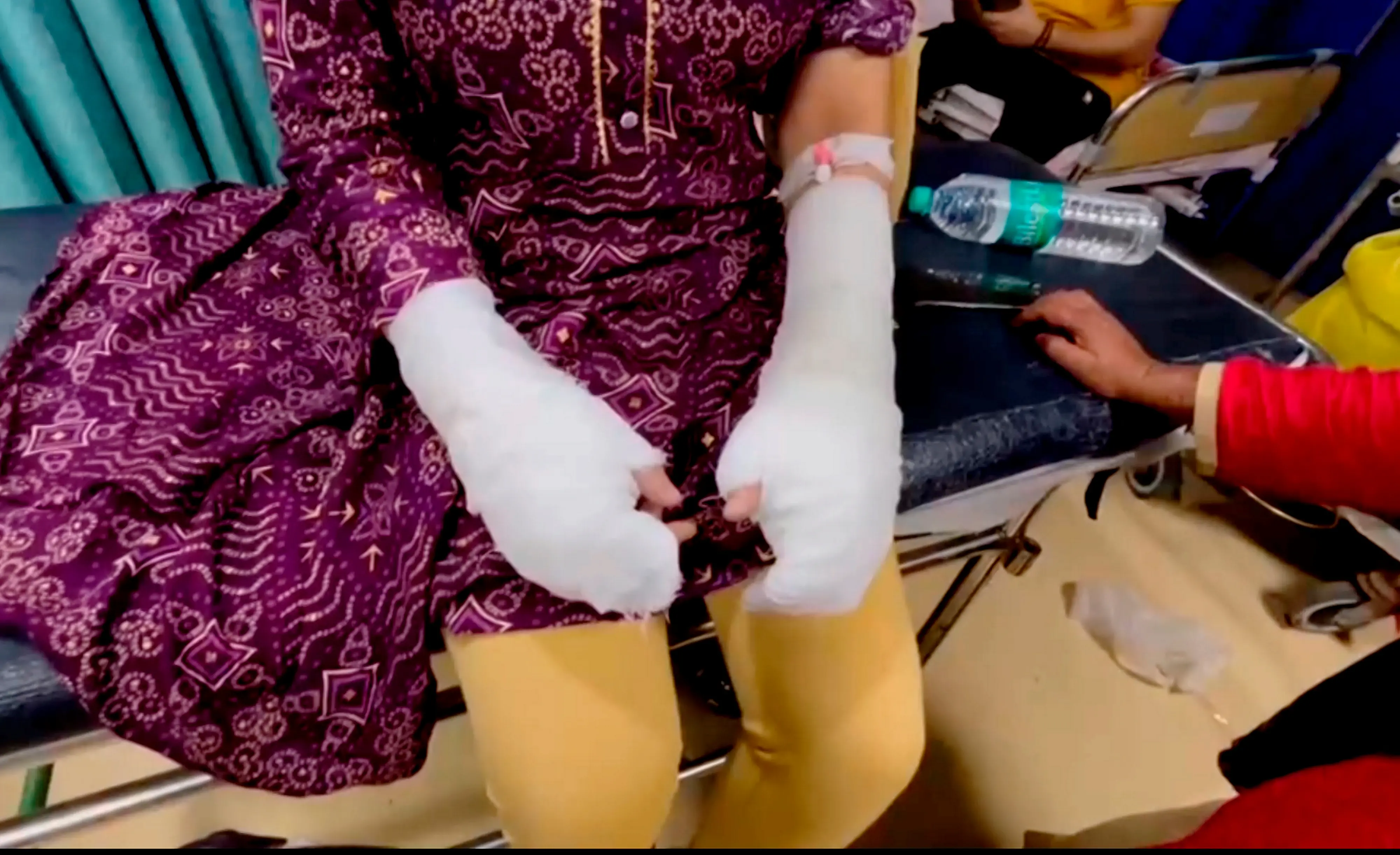 Woman undergoing treatment at the hospital following the acid attack | PTI