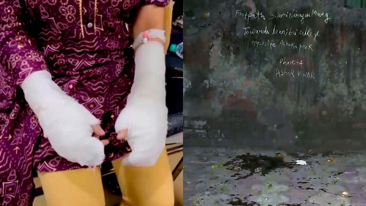 Shocking twist in DU acid attack case: victim’s father arrested for ...