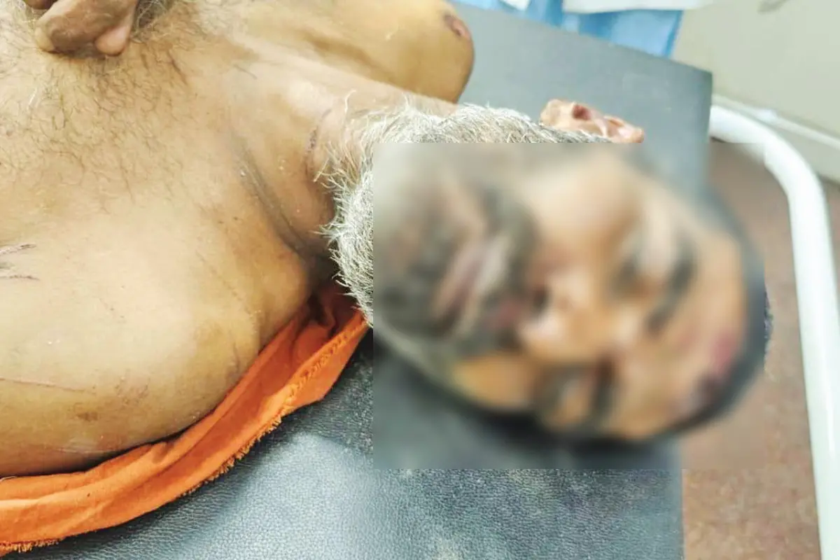 പരിക്കേറ്റ സുദർശൻ
