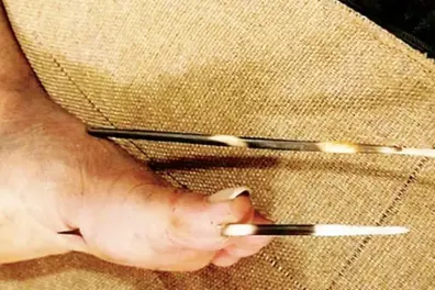 Porcupine quills pierce biker’s leg; Palakkad resident hospitalised after night attack