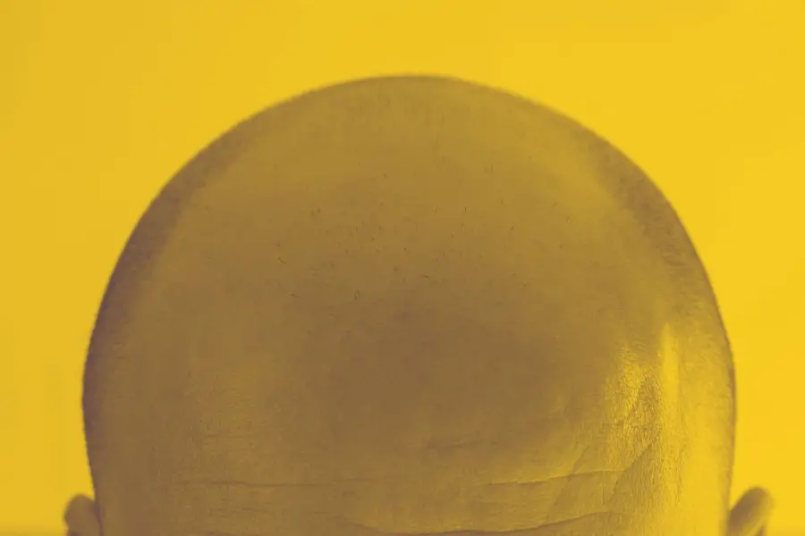 bald