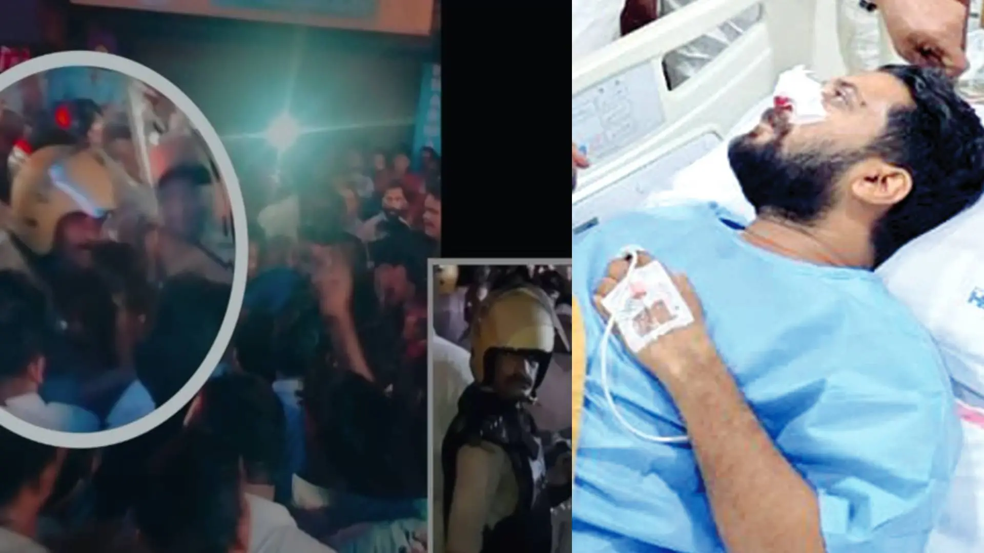 ഷാഫി പറമ്പിൽ വാർത്താസമ്മേളനത്തിൽ പുറത്തുവിട്ട ദൃശ്യം, ഷാഫി പരിക്കേറ്റ് ആശുപത്രിയിലായിരുന്നപ്പോൾ | Photo: Mathrubhumi