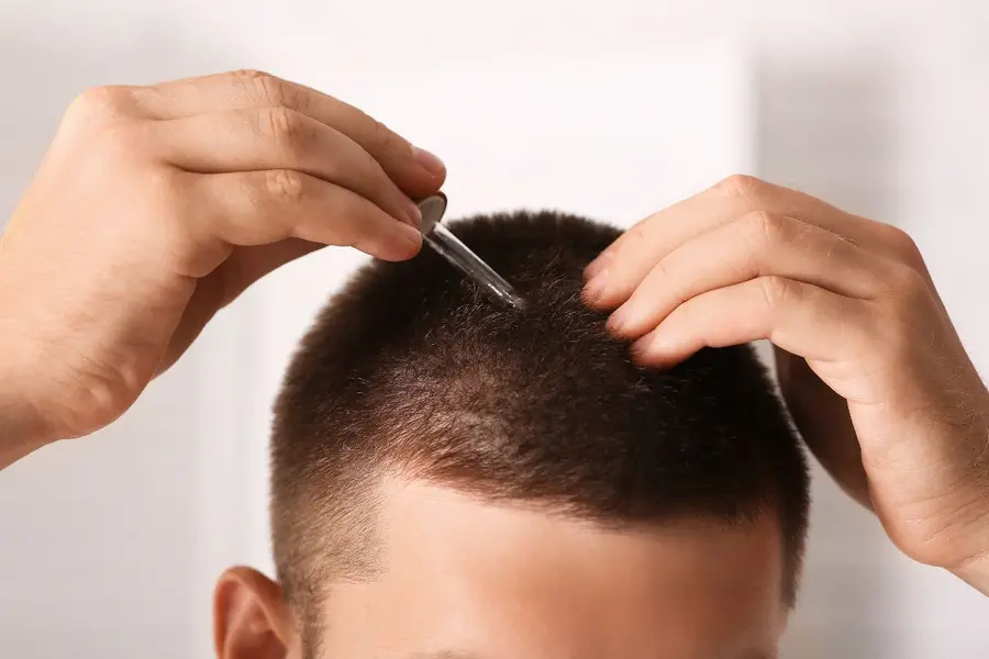Can this new serum really regrow hair in 20 days? Scientists reveal what’s true