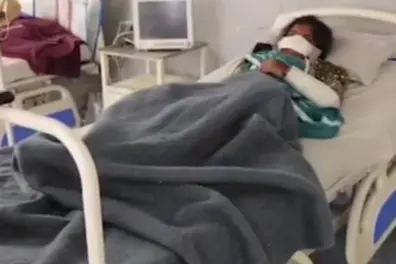 Shocking! Man cuts wife’s nose over suspicion in Madhya Pradesh’s Jhabua