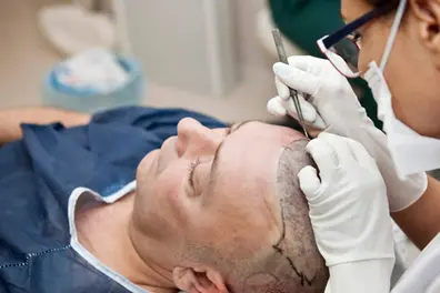World Hair Transplant Repair Day: Why celebrity cosmetic fails don’t tell the full story